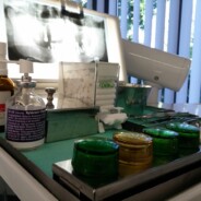 What to Do in a Dental Emergency: A Patient Guide from a Dental Clinic in Catford